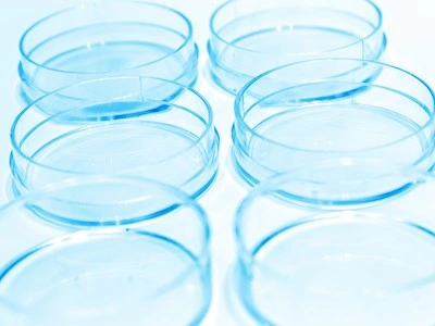 Mikrobiologi &amp; Infektionskontrol
Mycoplasmaafsnittet

T. 3268 3636 eller 3268 3635
@ afdMI@ssi.dk